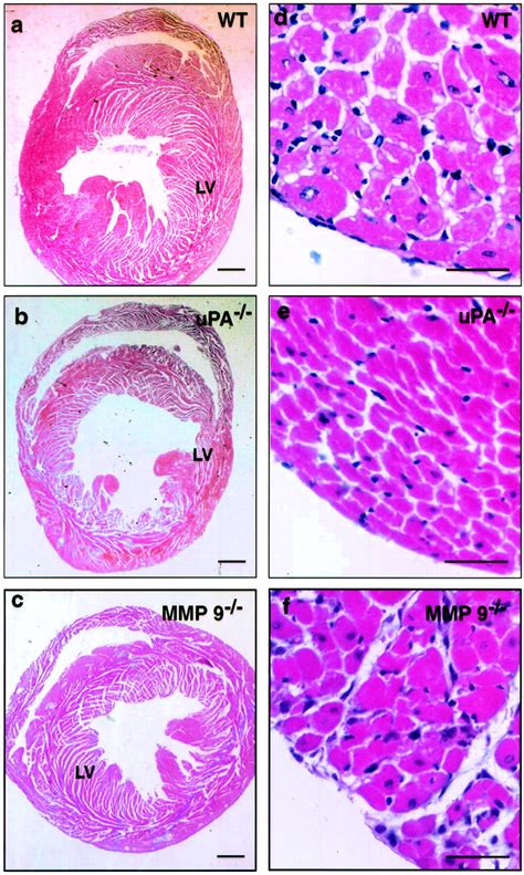 Loss or Inhibition of uPA or MMP